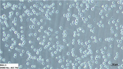 BALL1人B淋巴细胞白血病细胞  BALL-1